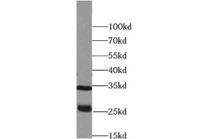 Western blot analysis of Raji cells subjected to SDS-PAGE, using PRSS2 antibody (1/500 dilution). (PRSS2 Antikörper)