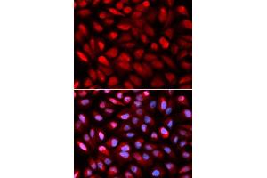 Immunofluorescence (IF) image for anti-Poly(rC) Binding Protein 2 (PCBP2) (AA 1-130) antibody (ABIN6219620) (PCBP2 Antikörper  (AA 1-130))