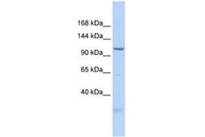 Image no. 1 for anti-Superkiller Viralicidic Activity 2-Like 2 (SKIV2L2) (AA 35-84) antibody (ABIN6742684) (MTR4 Antikörper  (AA 35-84))