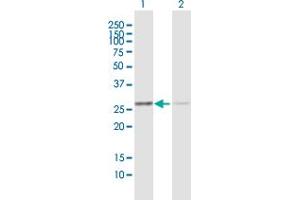 Western Blot analysis of ANP32B expression in transfected 293T cell line by ANP32B MaxPab polyclonal antibody. (ANP32B Antikörper  (AA 1-251))