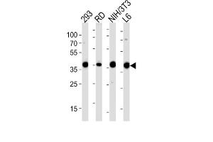 Western Blotting (WB) image for anti-Aldolase (ALD) antibody (ABIN3001589)