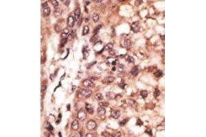 Image no. 2 for anti-CAMP Responsive Element Binding Protein 3-Like 1 (CREB3L1) (AA 490-519), (C-Term) antibody (ABIN358719) (CREB3L1 Antikörper  (C-Term))