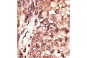 Image no. 2 for anti-CAMP Responsive Element Binding Protein 3-Like 1 (CREB3L1) (AA 490-519), (C-Term) antibody (ABIN358719)