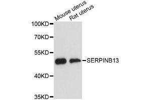 Western blot analysis of extracts of various cell lines, using SERPINB13 antibody. (SERPINB13 Antikörper  (AA 1-140))
