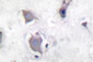 Image no. 2 for anti-Neurotrophic Tyrosine Kinase, Receptor, Type 2 (NTRK2) (pTyr705) antibody (ABIN318147) (TRKB Antikörper  (pTyr705))