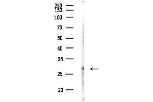 anti-Peroxisomal Membrane Protein 4 (PXMP4) (N-Term) antibody