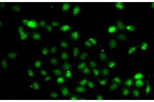 Immunofluorescence analysis of A549 cells using BCL6 Polyclonal Antibody (BCL6 Antikörper)