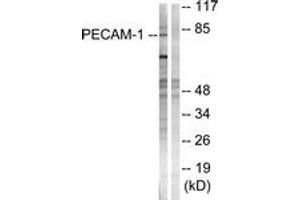 Western blot analysis of extracts from Jurkat cells, using PECAM-1 (Ab-713) Antibody. (CD31 Antikörper  (AA 686-735))