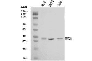 Western blot analysis of MAT2B/TGR using anti-MAT2B/TGR antibody (ABIN7601904).