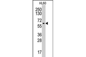 Western blot analysis of CYP19A1 polyclonal antibody  in HL-60 cell line lysates (35 ug/lane). (Aromatase Antikörper  (Internal Region))