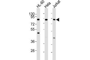 All lanes : Anti-IKK beta Antibody at 1:4000 dilution Lane 1: HL-60 whole cell lysates Lane 2: Hela whole cell lysates Lane 3: Jurkat whole cell lysates Lysates/proteins at 20 μg per lane.