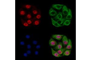 PHF8 Antibody staining Hela cells by IF/ICC. (PHF8 Antikörper  (C-Term))