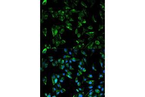 Immunofluorescence analysis of HeLa cell using TPM3 antibody. (TPM3 Antikörper)