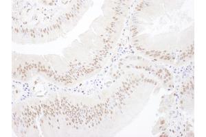 Immunohistochemistry (IHC) image for anti-Myocyte Enhancer Factor 2A (MEF2A) (AA 175-225) antibody (ABIN7454560) (MEF2A Antikörper  (AA 175-225))