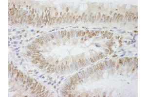 anti-Polymerase (DNA Directed), epsilon 3 (p17 Subunit) (POLE3) (AA 97-147) antibody