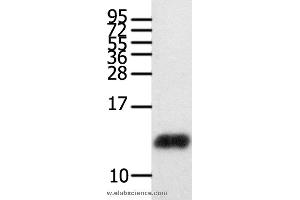 Western blot analysis of Human brain glioma tissue , using CCL28 Polyclonal Antibody at dilution of 1:450 (CCL28 Antikörper)