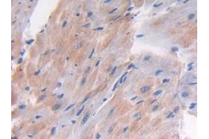 Immunohistochemistry (IHC) image for anti-Latent Transforming Growth Factor beta Binding Protein 1 (LTBP1) (AA 1415-1712) antibody (ABIN7440761)