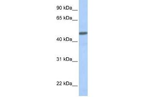CALCRL antibody used at 1 ug/ml to detect target protein. (CALCRL Antikörper  (N-Term))
