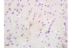 Formalin-fixed and paraffin embedded rat brain labeled with Anti Phospho-PKR (Thr446 + Thr451) Polyclonal Antibody (ABIN744818), Unconjugated at 1:200, followed by conjugation to the secondary antibody and DAB staining (EIF2AK2 Antikörper  (pThr446, pThr451))