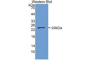 Western Blotting (WB) image for anti-Growth Arrest-Specific 6 (GAS6) (AA 136-311) antibody (ABIN3209085) (GAS6 Antikörper  (AA 136-311))