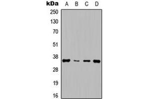 Western blot analysis of Cyclin D1 expression in HepG2 (A), NIH3T3 (B), rat muscle (C), rat kidney (D) whole cell lysates. (Cyclin D1 Antikörper  (Center))