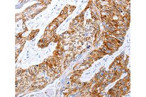 Immunohistochemistry (IHC) image for anti-Gastrin-Releasing Peptide Receptor (GRPR) (AA 235-384) antibody (ABIN6219927) (GRPR Antikörper  (AA 235-384))