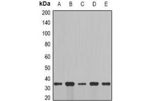 Western blot analysis of Cyclin C expression in MCF7 (A), NIH3T3 (B), mouse brain (C), mouse lung (D), rat liver (E) whole cell lysates. (Cyclin C Antikörper)