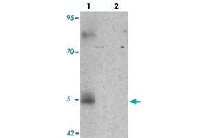 Western blot analysis of FOXD4L1 in A-20 cell lysate with FOXD4L1 polyclonal antibody  at 1 ug/mL in (lane 1) the absence and (lane 2) the presence of blocking peptide. (FOXD4L1 Antikörper  (C-Term))