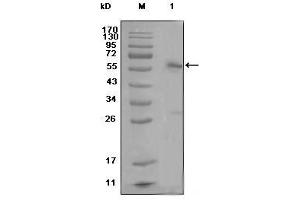 Western Blot showing ESR1 antibody used against MCF-7 cell lysate (1) (Estrogen Receptor alpha Antikörper)