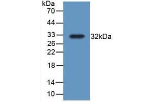 Detection of Recombinant TrxR1, Rat using Polyclonal Antibody to Thioredoxin Reductase 1 (TXNRD1) (TXNRD1 Antikörper  (AA 208-433))