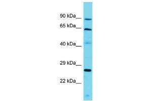 Host: Rabbit Target Name: CCDC79 Sample Type: Jurkat Whole Cell lysates Antibody Dilution: 1. (CCDC79 Antikörper  (C-Term))