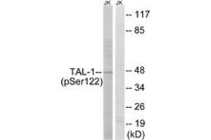 Western blot analysis of extracts from Jurkat cells treated with PMA 125ng/ml 30', using TAL-1 (Phospho-Ser122) Antibody. (TAL1 Antikörper  (pSer122))