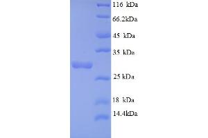 SDS-PAGE (SDS) image for Androgen-Induced 1 (AIG1) (AA 60-87), (partial) protein (GST tag) (ABIN5712836) (AIG1 Protein (AA 60-87, partial) (GST tag))