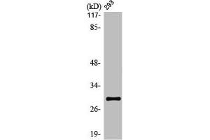 Western Blot analysis of Jurkat cells using Olfactory receptor 10J1 Polyclonal Antibody (OR1J1 Antikörper  (C-Term))