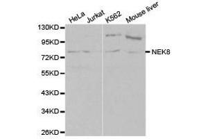 Western Blotting (WB) image for anti-NIMA-Related Kinase 8 (NEK8) antibody (ABIN1873874) (NEK8 Antikörper)