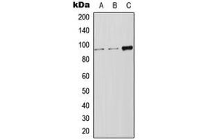 Western blot analysis of LRP12 expression in Jurkat (A), HeLa (B), SP2/0 (C) whole cell lysates.