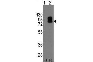 Image no. 2 for anti-CD19 Molecule (CD19) (C-Term) antibody (ABIN357030) (CD19 Antikörper  (C-Term))
