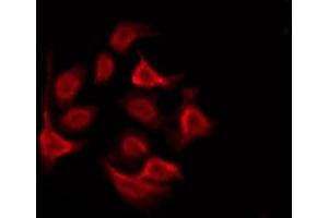 ABIN6276025 staining Hela by IF/ICC. (GPRC5D Antikörper  (Internal Region))
