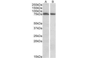 AP23695PU-N STK39 / SPAK Antibody of Mouse (A) and Rat (B) Brain (35µg protein in RIPA buffer). (STK39 Antikörper  (Internal Region))