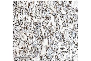 IHC analysis of DDX5 using anti-DDX5 antibody (ABIN7602561). (DDX5 Antikörper  (AA 85-328))