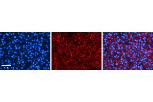 Rabbit Anti-PDLIM5 Antibody   Formalin Fixed Paraffin Embedded Tissue: Human Liver Tissue Observed Staining: Cytoplasm in hepatocytes Primary Antibody Concentration: 1:100 Other Working Concentrations: N/A Secondary Antibody: Donkey anti-Rabbit-Cy3 Secondary Antibody Concentration: 1:200 Magnification: 20X Exposure Time: 0. (PDLIM5 Antikörper  (Middle Region))