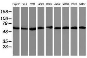 Image no. 6 for anti-V-Akt Murine Thymoma Viral Oncogene Homolog 1 (AKT1) antibody (ABIN1496554) (AKT1 Antikörper)