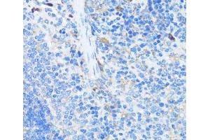 Immunohistochemistry (Paraffin-embedded Sections) (IHC (p)) image for anti-Eukaryotic Translation Initiation Factor 3 Subunit J (EIF3S1) antibody (ABIN7264670)