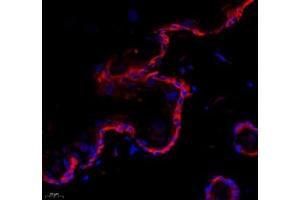 Immunofluorescence of paraffin embedded rat skin using collagen alpha-1 (V) (ABIN7073547) at dilution of 1: 1500 (400x lens) (Collagen Type V Antikörper)