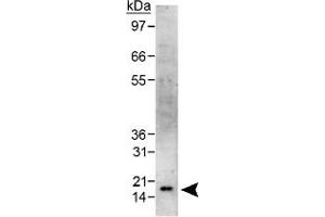 Western blot analysis of CBX5 in HeLa whole cell lysate using CBX5 polyclonal antibody . (CBX5 Antikörper  (AA 1-100))