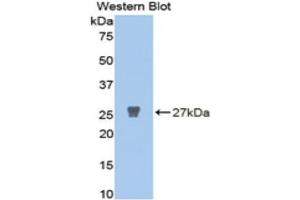Western Blotting (WB) image for anti-Matrix Metalloproteinase 2 (MMP2) (AA 445-660) antibody (ABIN1078307) (MMP2 Antikörper  (AA 445-660))