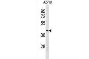 Western Blotting (WB) image for anti-Dipeptidase 1 (Renal) (DPEP1) antibody (ABIN3001069) (DPEP1 Antikörper)