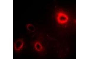 Immunofluorescent analysis of RPLP1 staining in SW480 cells.