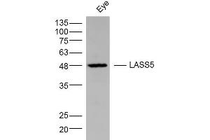 Mouse Eye lysates probed with LASS5 Polyclonal Antibody, Unconjugated  at 1:300 dilution and 4˚C overnight incubation. (LASS5 Antikörper  (AA 101-200))