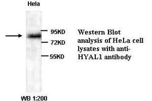 Image no. 1 for anti-Hyaluronidase-1 (HYAL1) (Internal Region) antibody (ABIN791003) (HYAL1 Antikörper  (Internal Region))